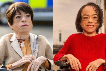 Liz Carr Disability