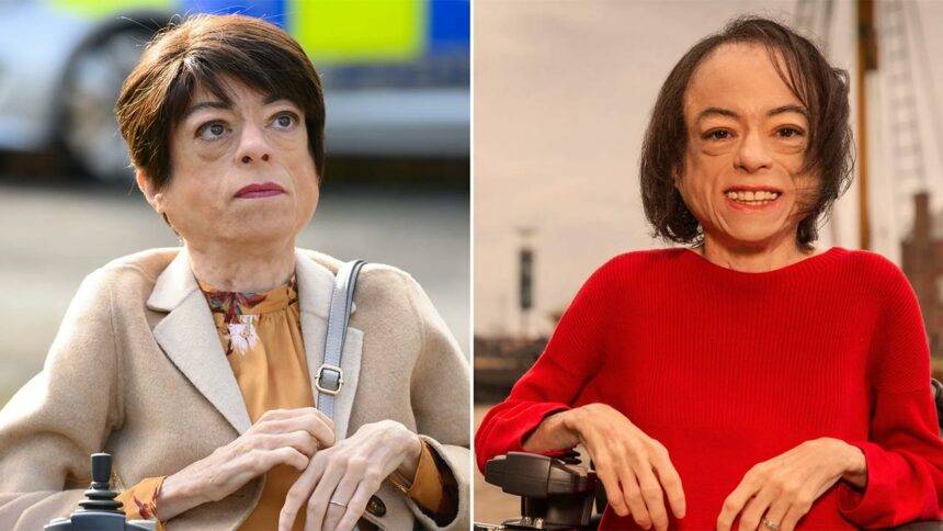 Liz Carr Disability, Know Illness or Disease, Check Medical Condition ...