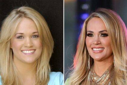 Carrie Underwood Accident Injury