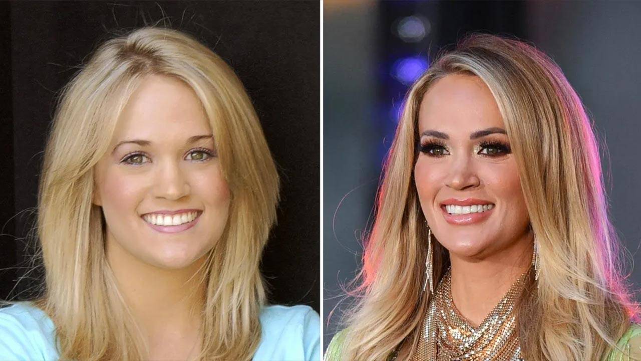 Carrie Underwood Accident Injury What Happened to Carrie Underwood