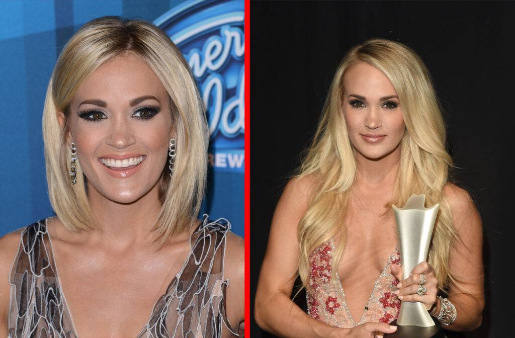 Carrie Underwood Face Plastic Surgery F